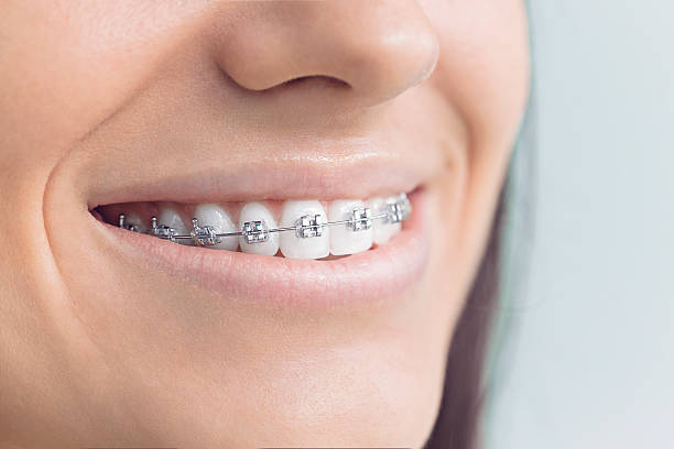 Best Tooth Extraction  in Wylie, TX